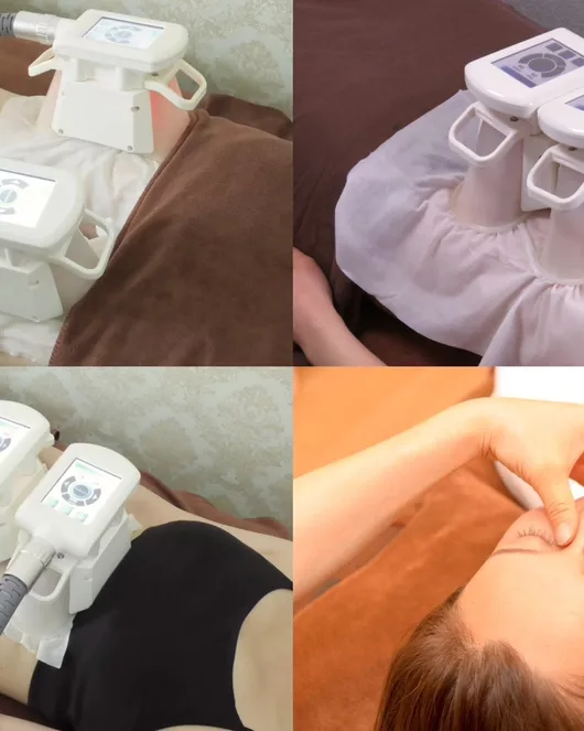 Fat Freezing (4 Areas) + Head Massage – 80 minutes
